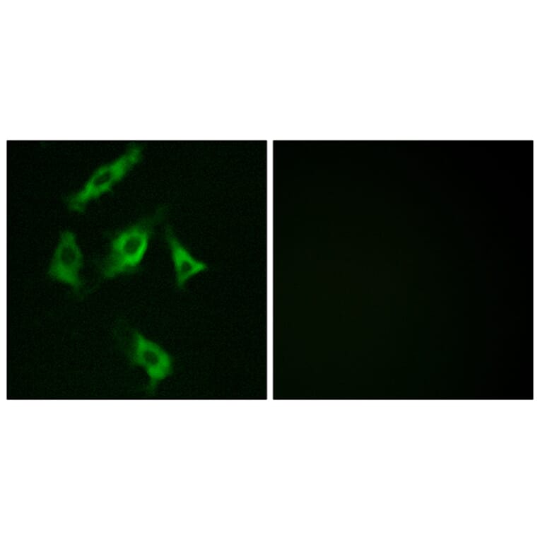 Immunofluorescence - Anti-Stathmin 1 Antibody (B7230) - Antibodies.com