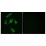 Immunofluorescence - Anti-Stathmin 1 Antibody (B7230) - Antibodies.com