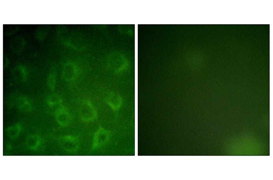 Immunofluorescence - Anti-PDGFR beta Antibody (B0971) - Antibodies.com