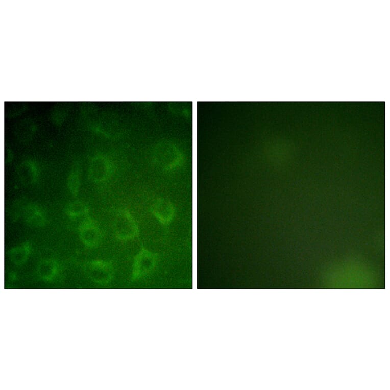 Immunofluorescence - Anti-PDGFR beta Antibody (B0971) - Antibodies.com