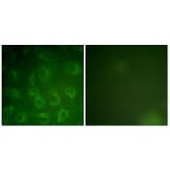 Immunofluorescence - Anti-PDGFR beta Antibody (B0971) - Antibodies.com