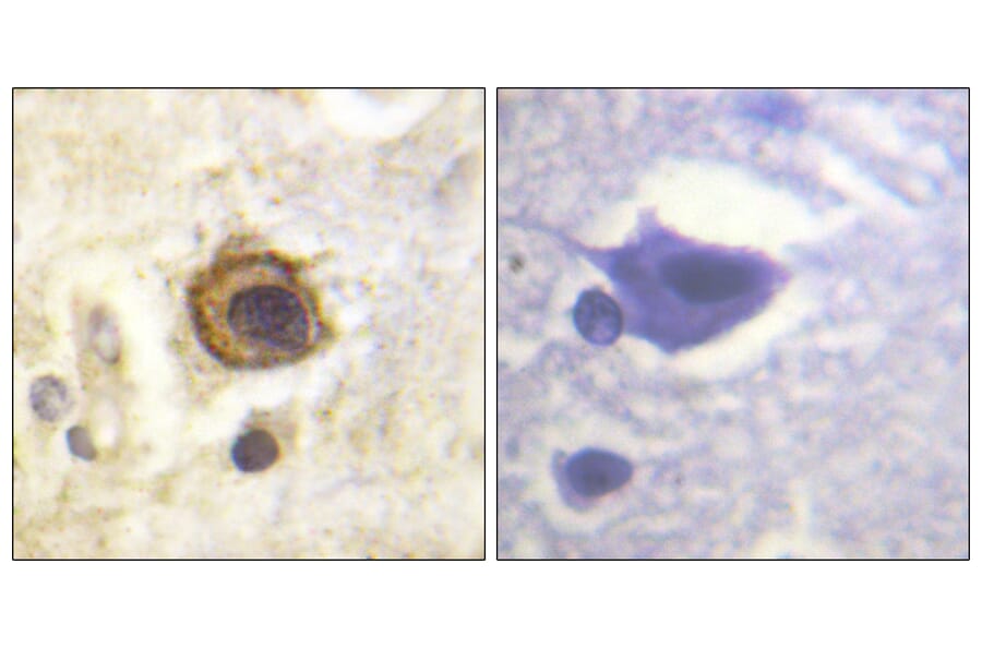 Immunohistochemistry - Anti-PDGFR beta Antibody (B0971) - Antibodies.com