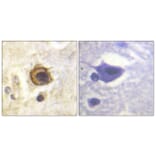Immunohistochemistry - Anti-PDGFR beta Antibody (B0971) - Antibodies.com