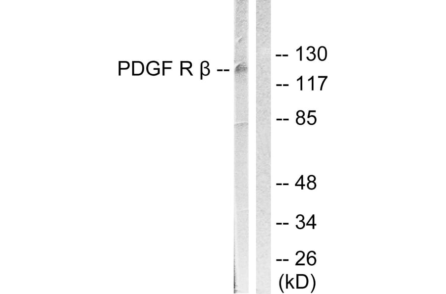 Western Blot - Anti-PDGFR beta Antibody (B0971) - Antibodies.com