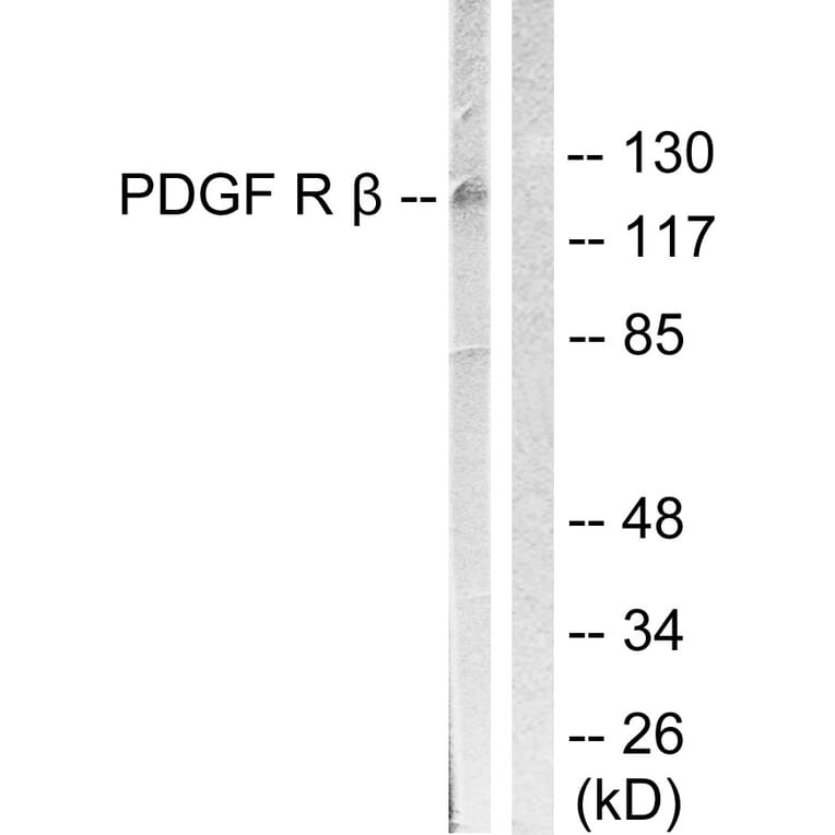 Western Blot - Anti-PDGFR beta Antibody (B0971) - Antibodies.com