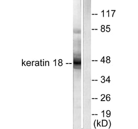 Western Blot - Anti-Keratin 18 Antibody (C0243) - Antibodies.com