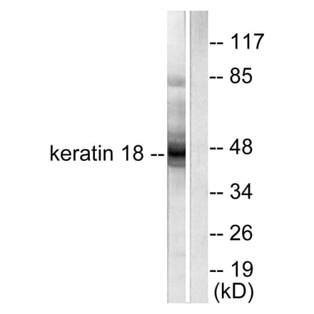Western Blot - Anti-Keratin 18 Antibody (C0243) - Antibodies.com