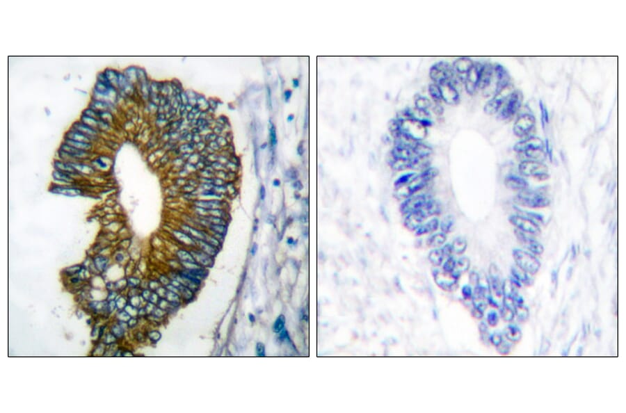 Immunohistochemistry - Anti-Keratin 18 Antibody (C0243) - Antibodies.com