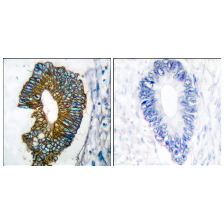 Immunohistochemistry - Anti-Keratin 18 Antibody (C0243) - Antibodies.com