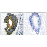 Immunohistochemistry - Anti-Keratin 18 Antibody (C0243) - Antibodies.com