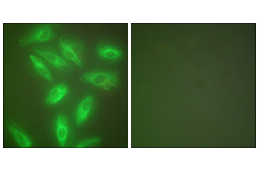 Immunofluorescence - Anti-Keratin 18 Antibody (C0243) - Antibodies.com