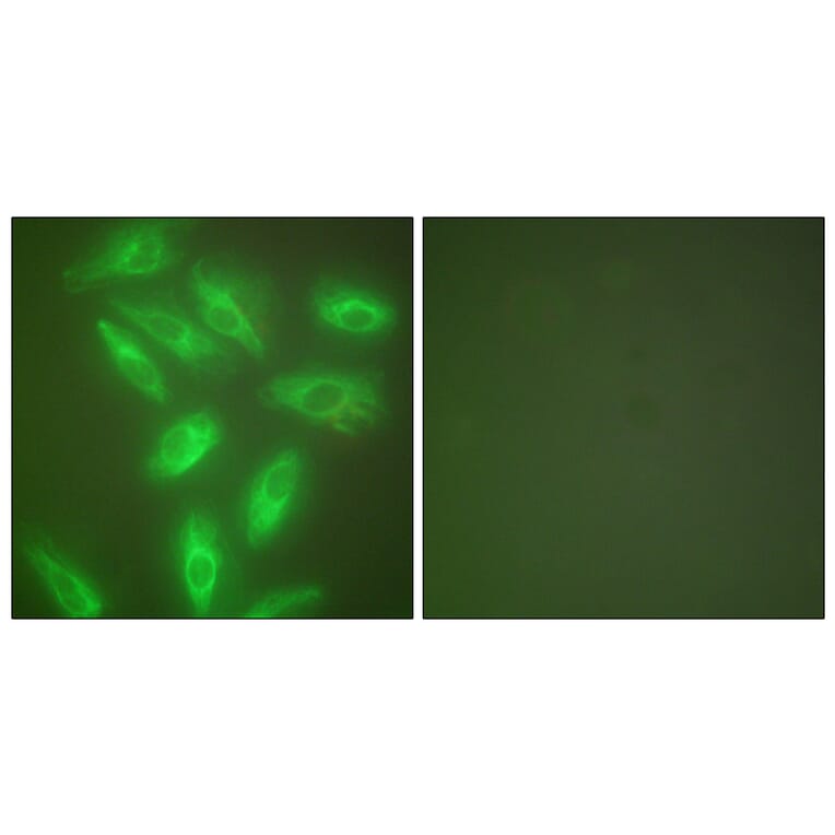 Immunofluorescence - Anti-Keratin 18 Antibody (C0243) - Antibodies.com