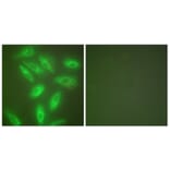 Immunofluorescence - Anti-Keratin 18 Antibody (C0243) - Antibodies.com