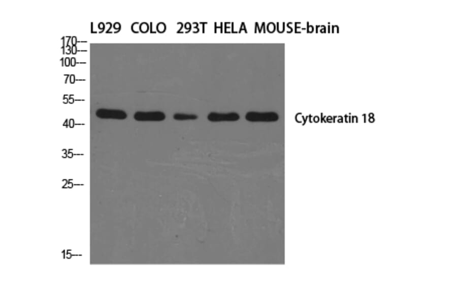 Western Blot - Anti-Keratin 18 Antibody (C0243) - Antibodies.com