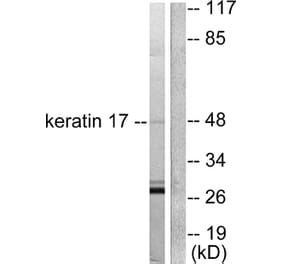 Western Blot - Anti-Keratin 17 Antibody (C0242) - Antibodies.com