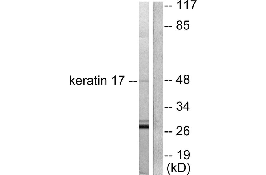 Western Blot - Anti-Keratin 17 Antibody (C0242) - Antibodies.com
