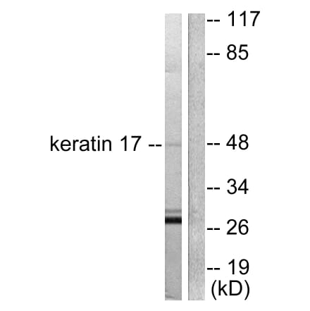 Western Blot - Anti-Keratin 17 Antibody (C0242) - Antibodies.com