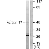 Western Blot - Anti-Keratin 17 Antibody (C0242) - Antibodies.com