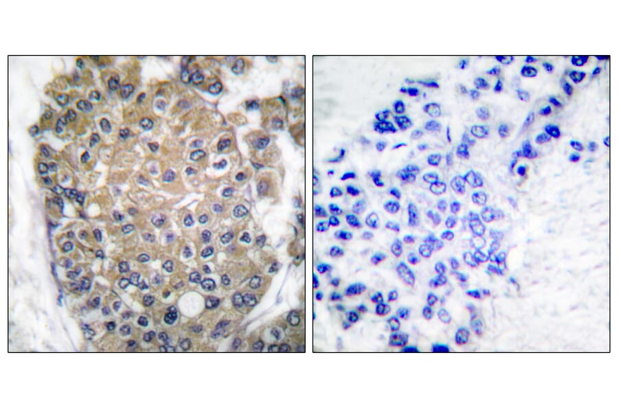 Immunohistochemistry - Anti-Keratin 17 Antibody (C0242) - Antibodies.com