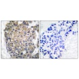 Immunohistochemistry - Anti-Keratin 17 Antibody (C0242) - Antibodies.com