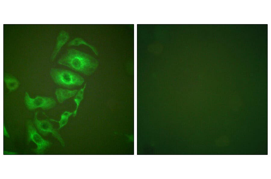 Immunofluorescence - Anti-Keratin 17 Antibody (C0242) - Antibodies.com