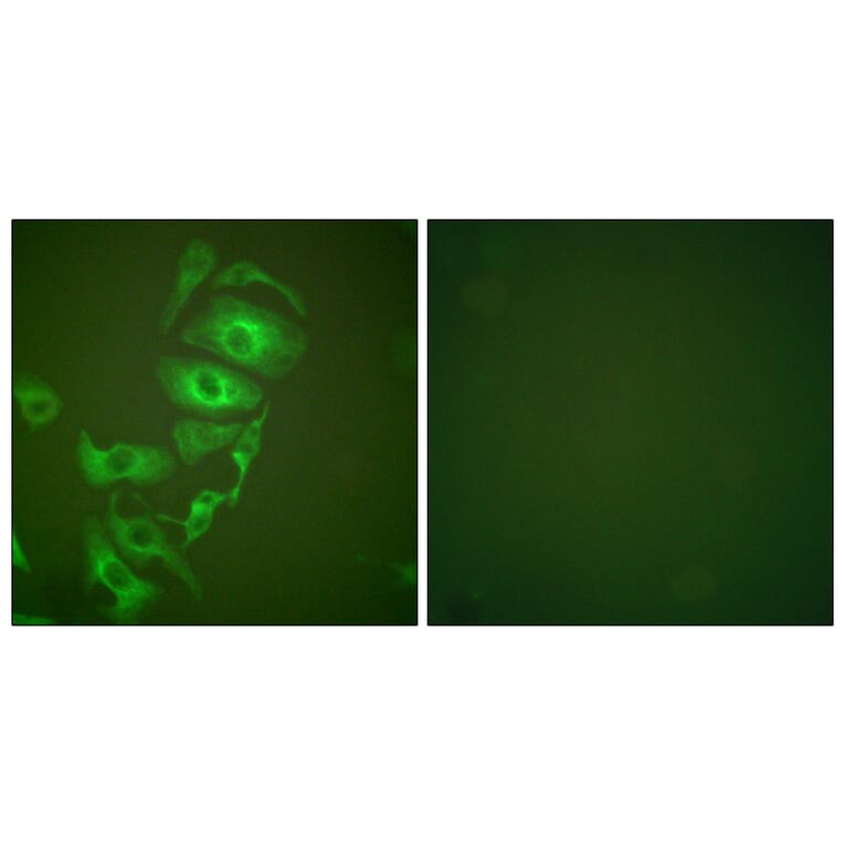 Immunofluorescence - Anti-Keratin 17 Antibody (C0242) - Antibodies.com