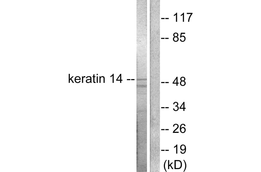 Western Blot - Anti-Keratin 14 Antibody (C0239) - Antibodies.com