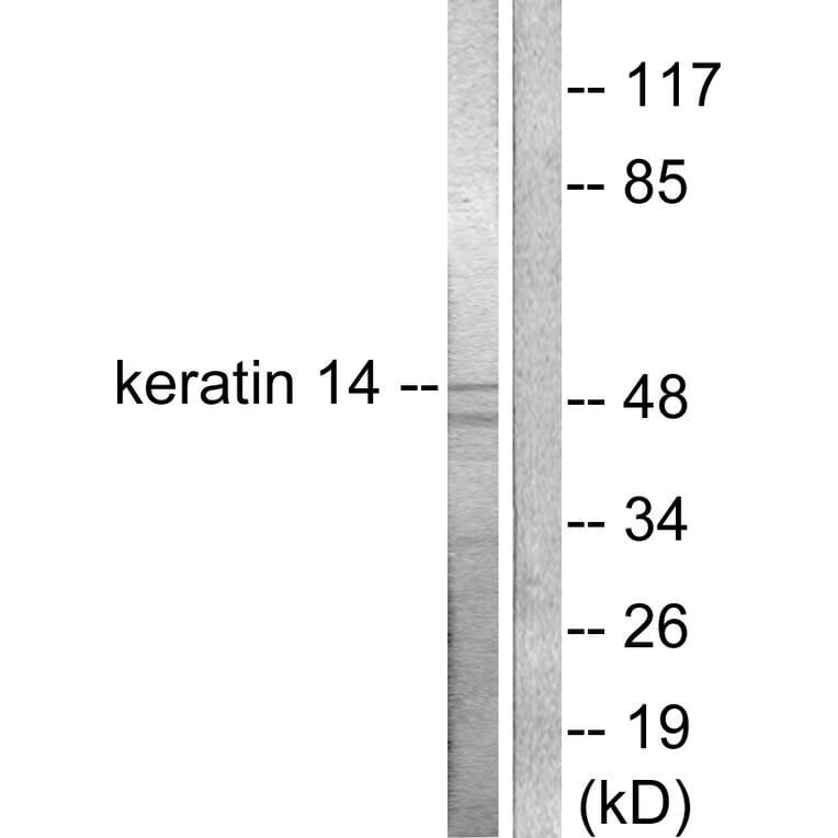 Western Blot - Anti-Keratin 14 Antibody (C0239) - Antibodies.com