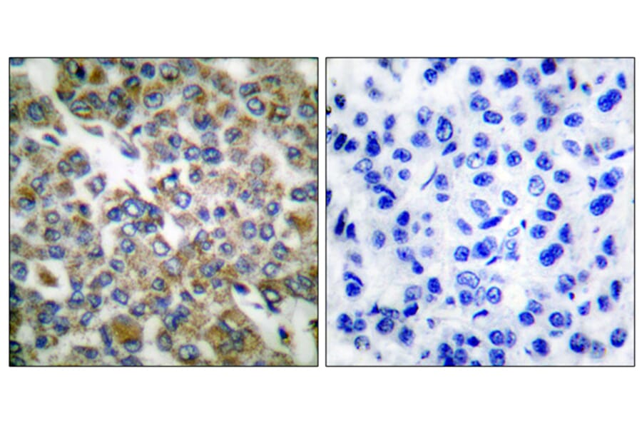 Immunohistochemistry - Anti-Keratin 14 Antibody (C0239) - Antibodies.com