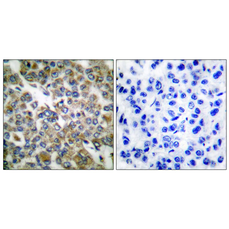 Immunohistochemistry - Anti-Keratin 14 Antibody (C0239) - Antibodies.com