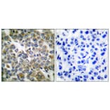 Immunohistochemistry - Anti-Keratin 14 Antibody (C0239) - Antibodies.com