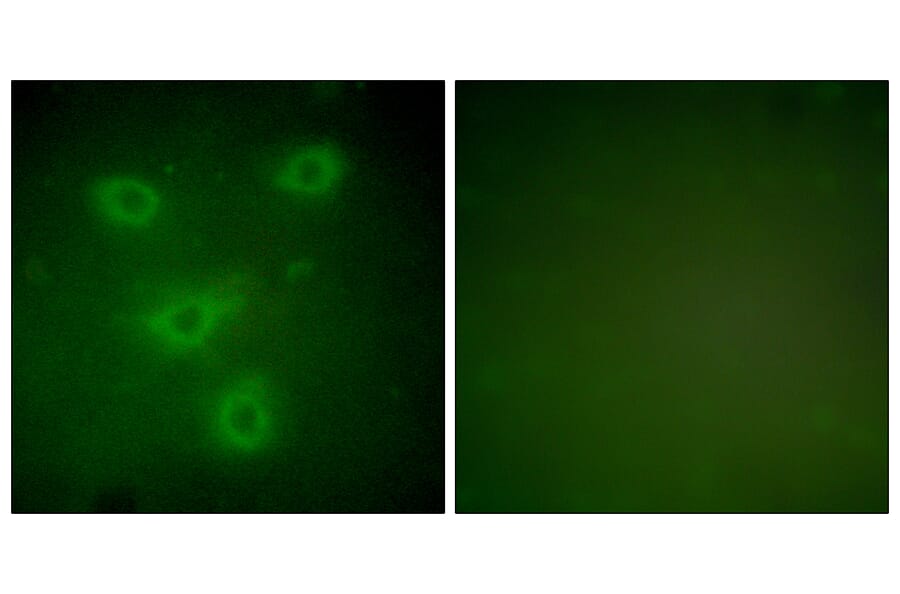 Immunofluorescence - Anti-Keratin 14 Antibody (C0239) - Antibodies.com