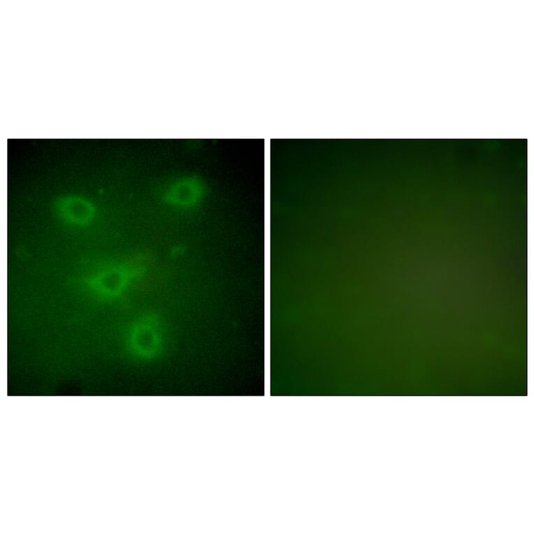 Immunofluorescence - Anti-Keratin 14 Antibody (C0239) - Antibodies.com