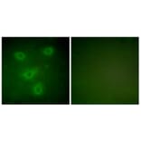Immunofluorescence - Anti-Keratin 14 Antibody (C0239) - Antibodies.com