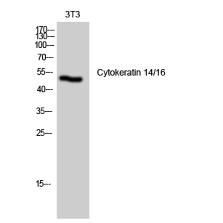 Western Blot - Anti-Keratin 14 Antibody (C0239) - Antibodies.com
