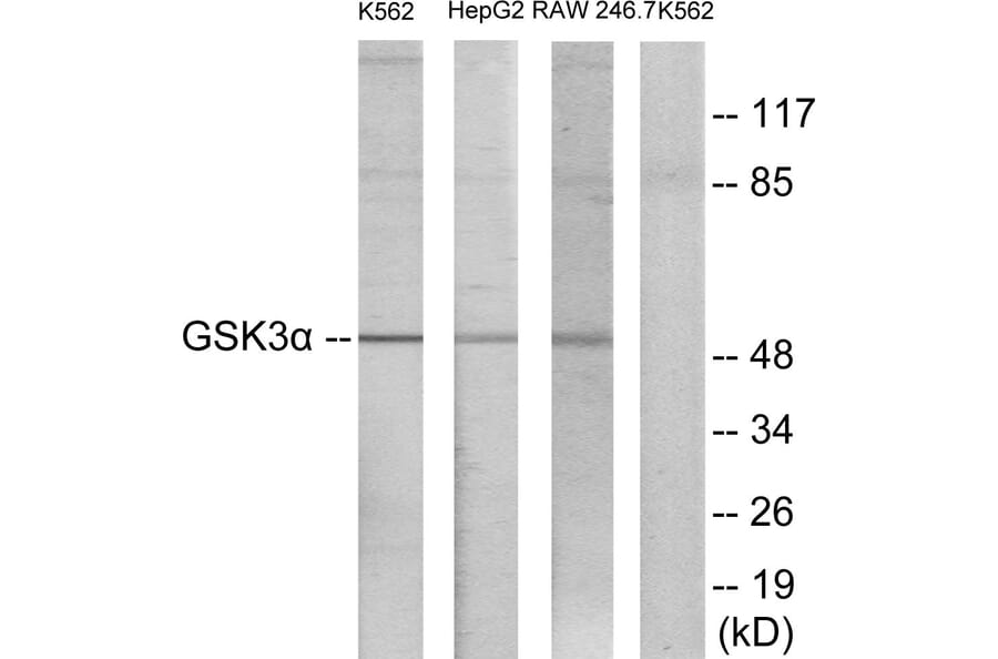 Western Blot - Anti-GSK3 alpha Antibody (B7097) - Antibodies.com