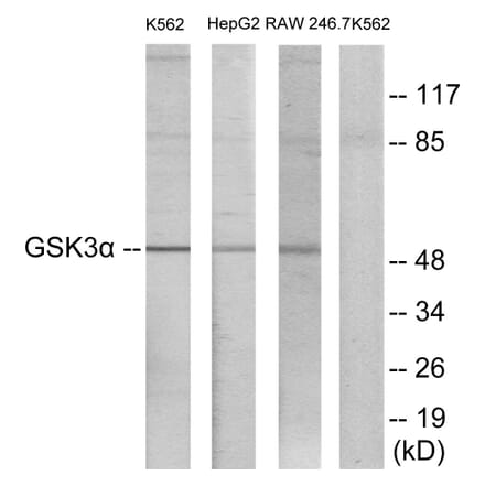 Western Blot - Anti-GSK3 alpha Antibody (B7097) - Antibodies.com