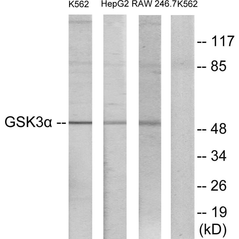 Western Blot - Anti-GSK3 alpha Antibody (B7097) - Antibodies.com