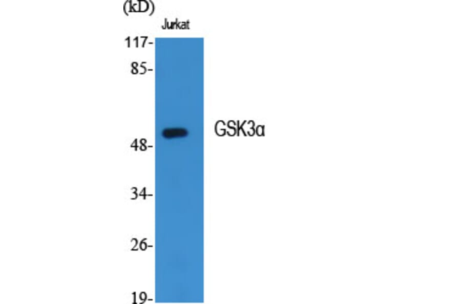 Western Blot - Anti-GSK3 alpha Antibody (B7097) - Antibodies.com