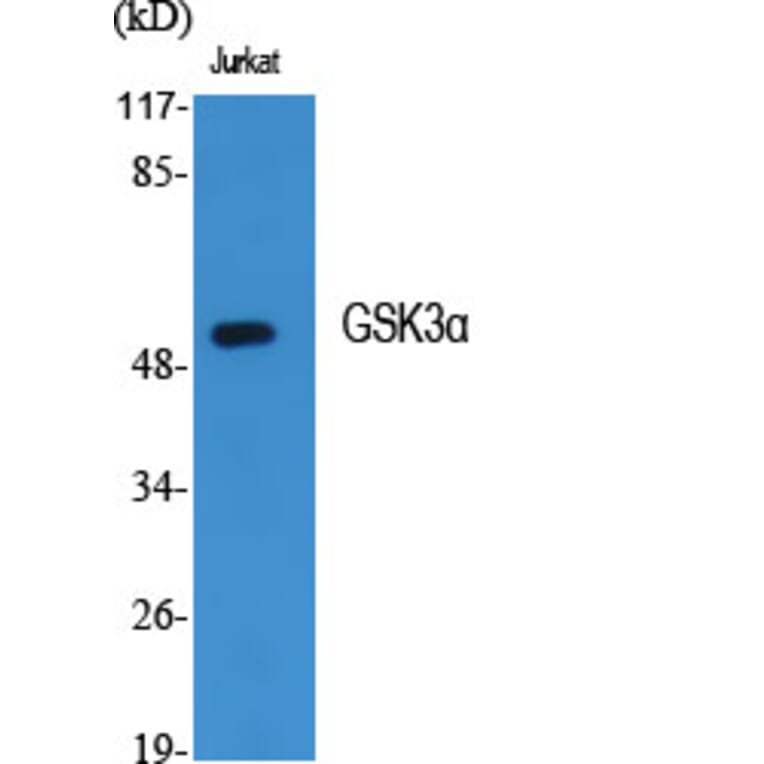 Western Blot - Anti-GSK3 alpha Antibody (B7097) - Antibodies.com