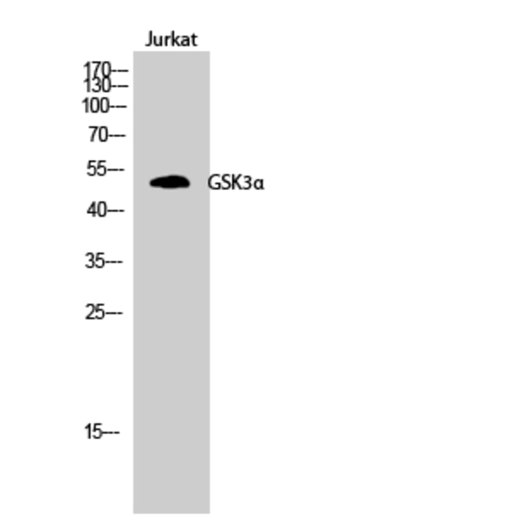 Western Blot - Anti-GSK3 alpha Antibody (B7097) - Antibodies.com