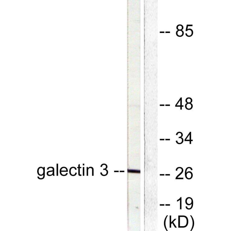 Western Blot - Anti-Galectin 3 Antibody (C0203) - Antibodies.com