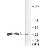 Western Blot - Anti-Galectin 3 Antibody (C0203) - Antibodies.com