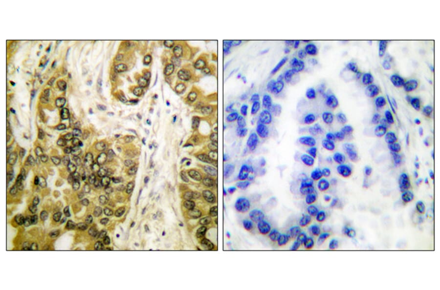 Immunohistochemistry - Anti-Galectin 3 Antibody (C0203) - Antibodies.com