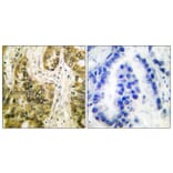 Immunohistochemistry - Anti-Galectin 3 Antibody (C0203) - Antibodies.com