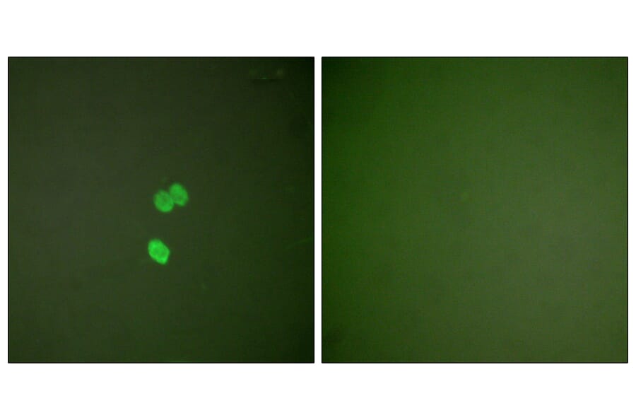 Immunofluorescence - Anti-Galectin 3 Antibody (C0203) - Antibodies.com