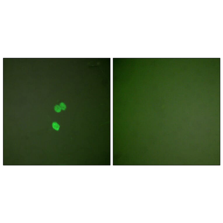 Immunofluorescence - Anti-Galectin 3 Antibody (C0203) - Antibodies.com