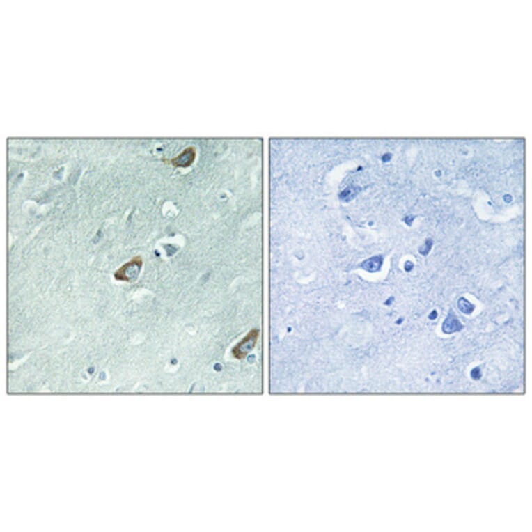 Immunohistochemistry - Anti-Calmodulin Antibody (B0829) - Antibodies.com