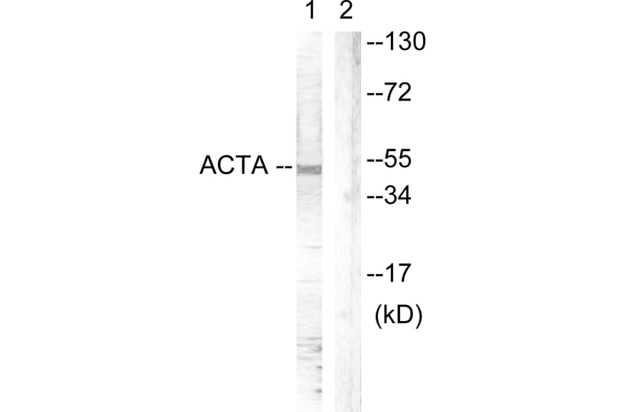 Western Blot - Anti-Actin-pan Antibody (B0762) - Antibodies.com