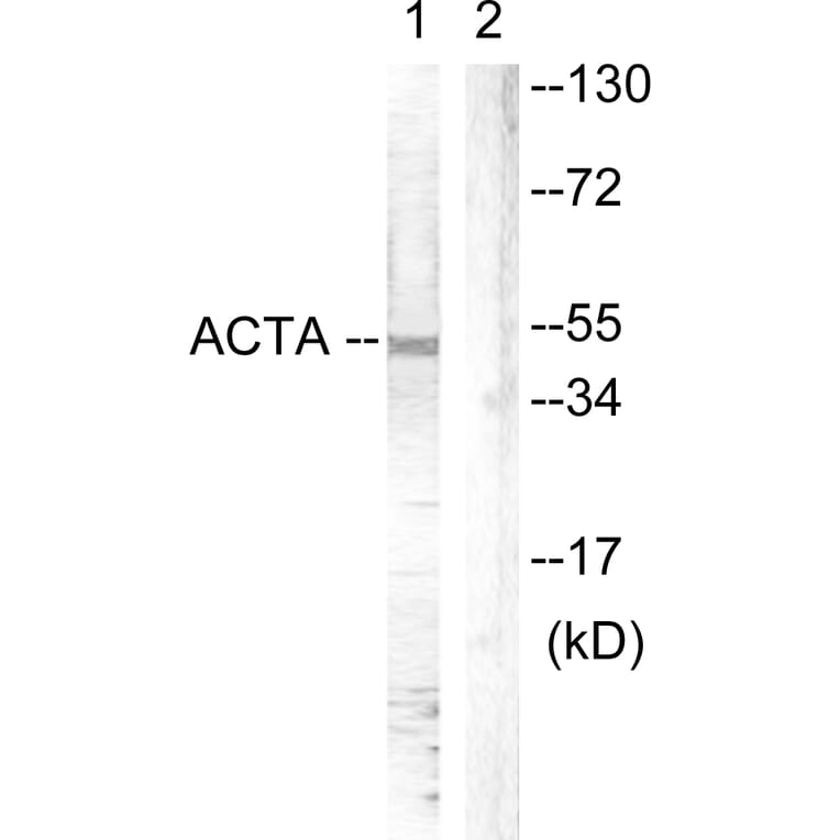 Western Blot - Anti-Actin-pan Antibody (B0762) - Antibodies.com
